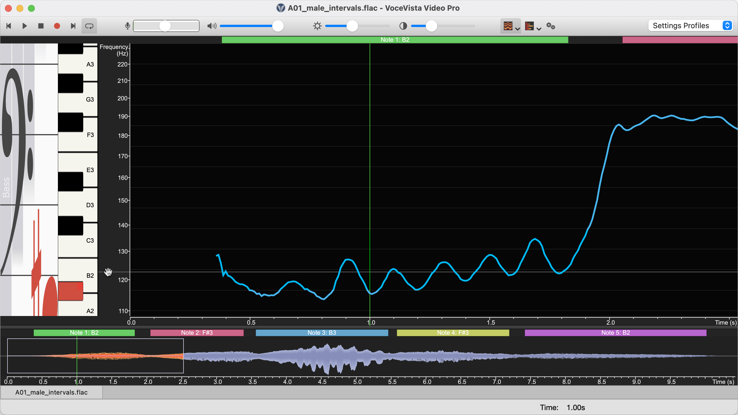 qs a01 zoom2